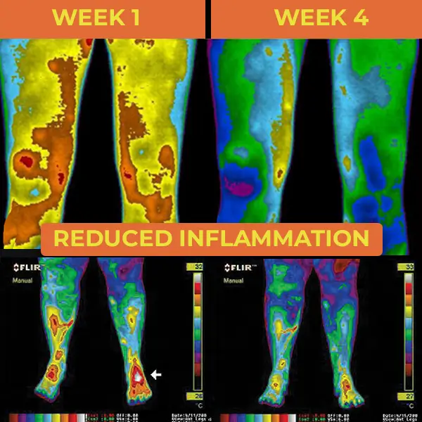 Nooro Grounding Mat Reduced Inflammation